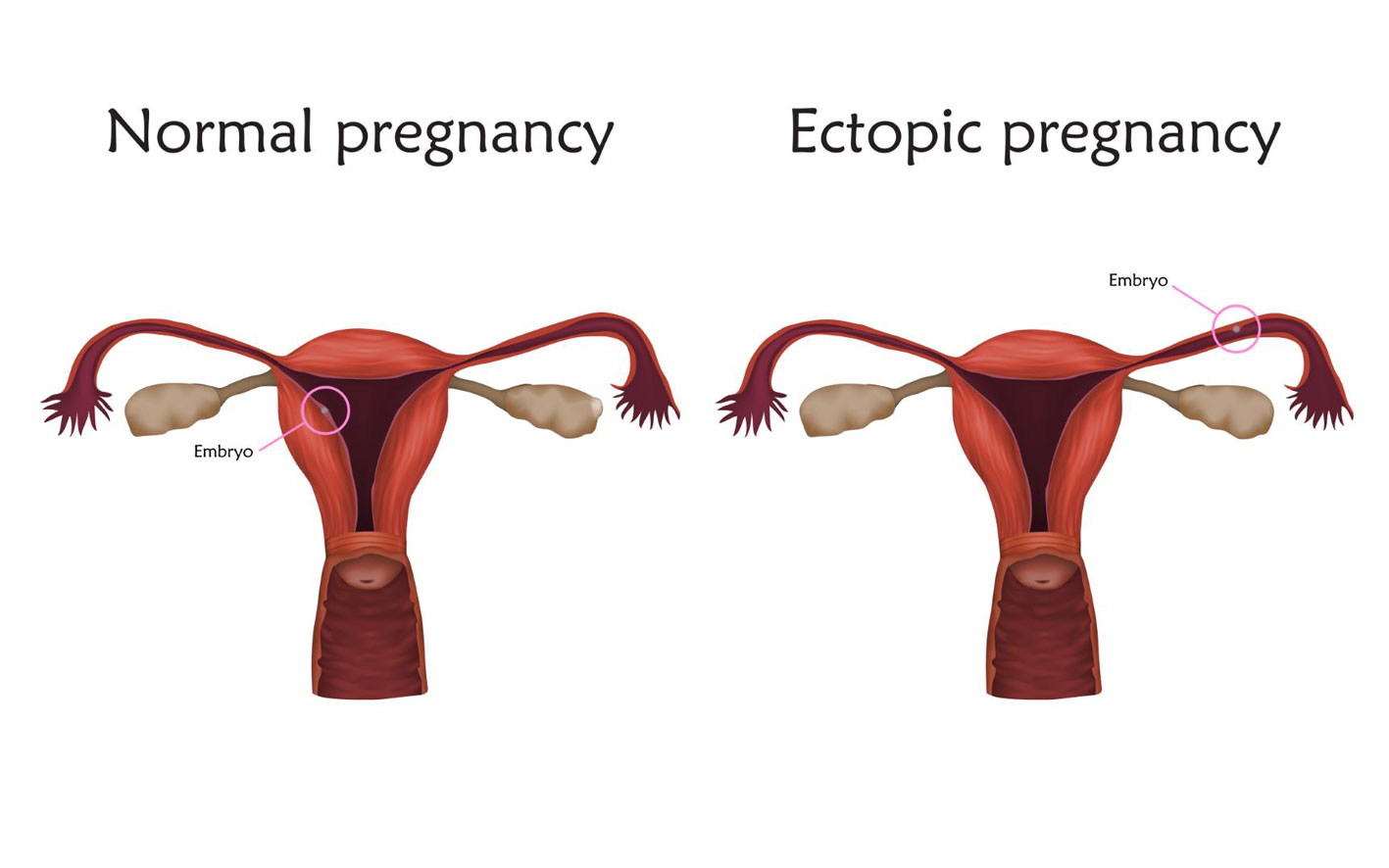 Reproduksi wanita