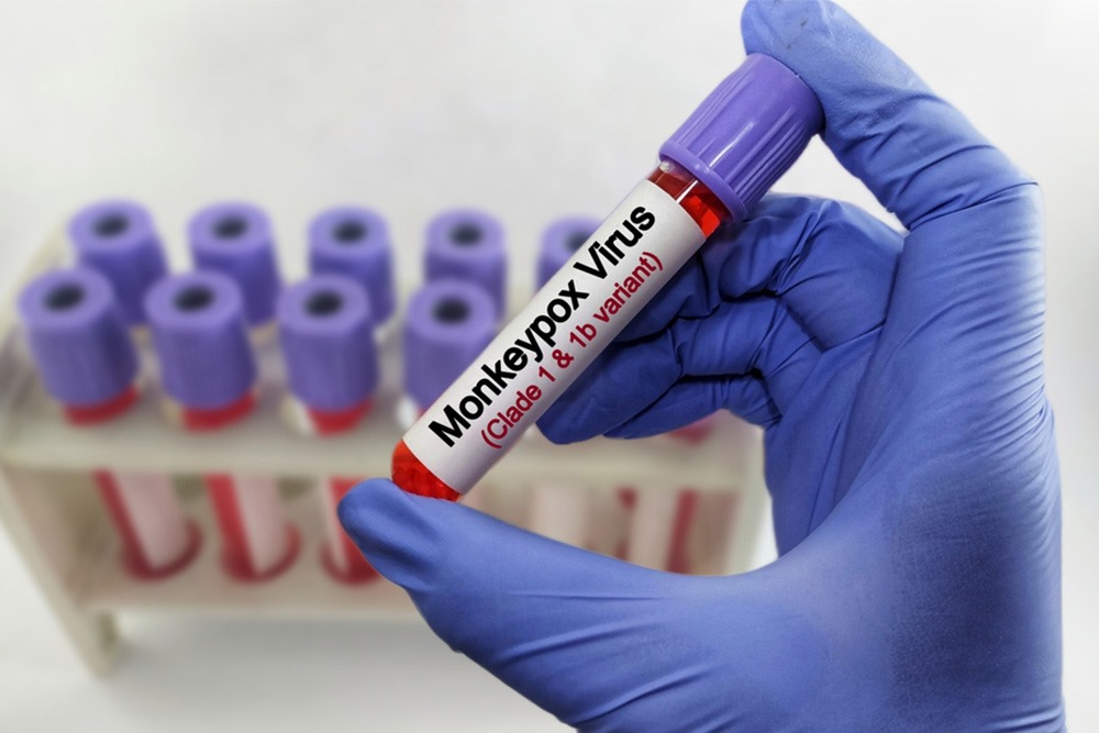 Monkeypox adalah